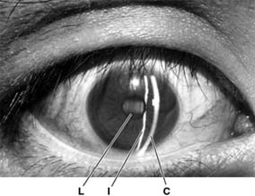 Figure 2-5
