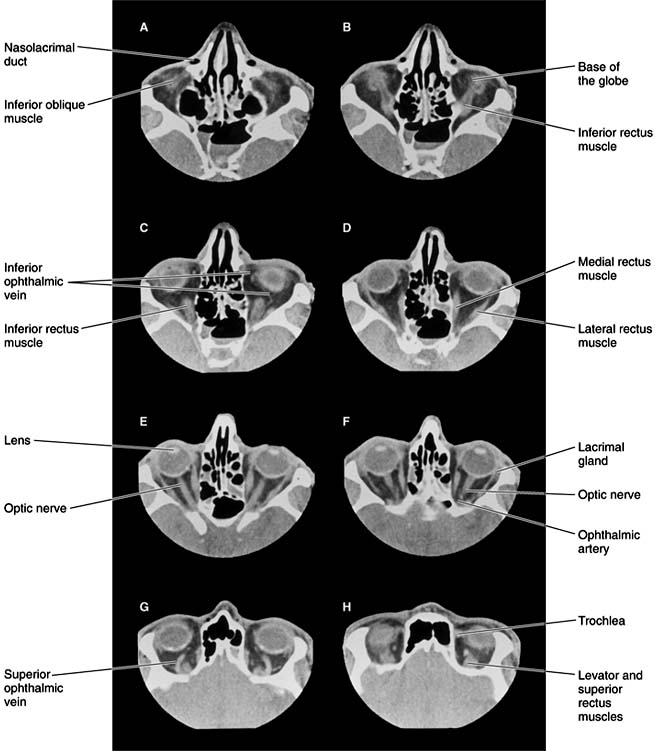 Figure 13-1